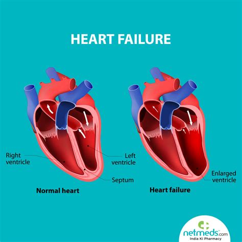 treatment for left ventricular dysfunction